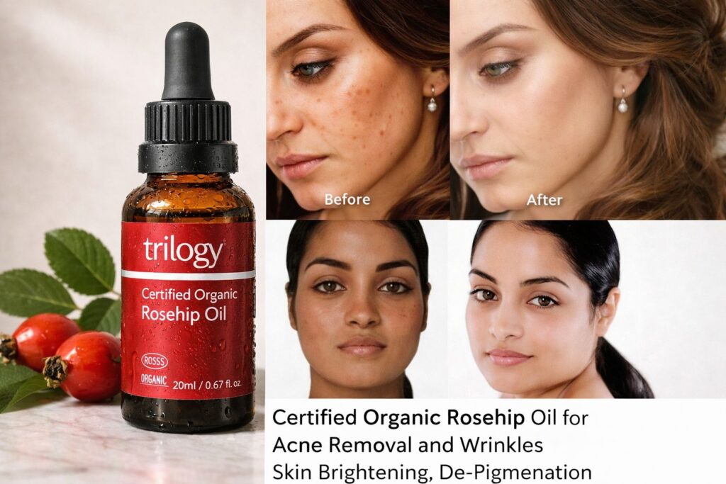 rosehip oil moisturiser features